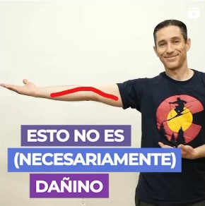 post hiperlaxitud de codo