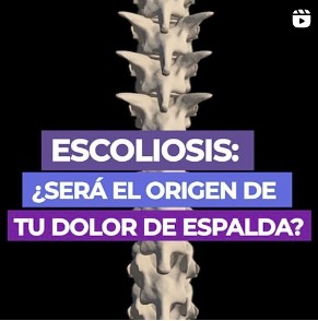escoliosis-articulo