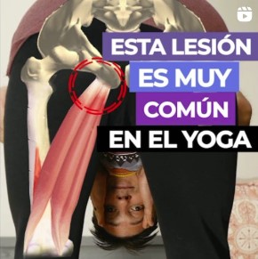 tendinitis-isquiotibiales